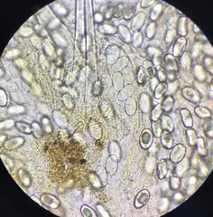 Lasiobolus intermedius