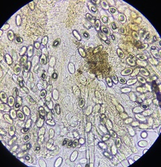 Lasiobolus intermedius