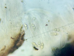 Kirschsteiniothelia atra