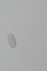 Mycoblastus sanguinarius