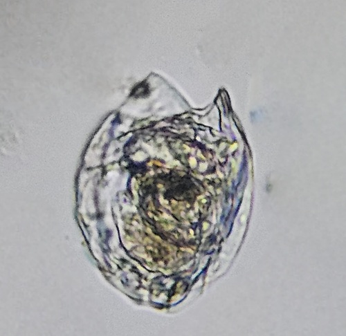 Lecane bulla