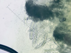 Pertusaria consocians