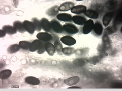 Xylaria corniformis