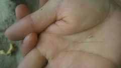 Mastonia cingulifera