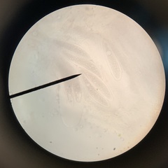 Pertusaria sinusmexicani