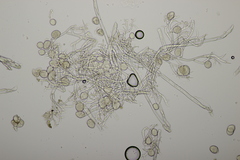 Peronospora hiemalis