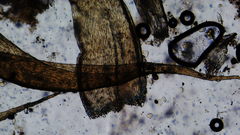 Stereodon subimponens