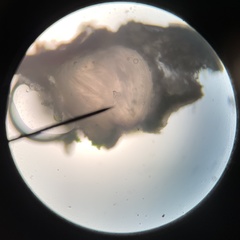 Pertusaria sinusmexicani