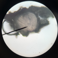 Pertusaria sinusmexicani