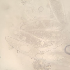 Pertusaria sinusmexicani