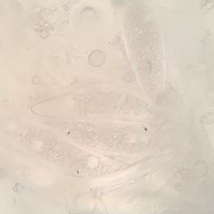 Pertusaria sinusmexicani