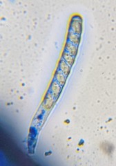 Dumontinia tuberosa