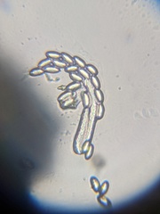 Dumontinia tuberosa