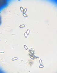 Dumontinia tuberosa