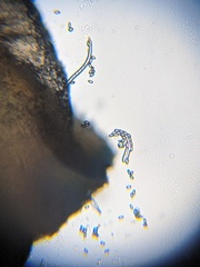 Dumontinia tuberosa