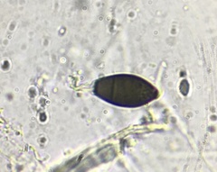 Cercophora silvatica