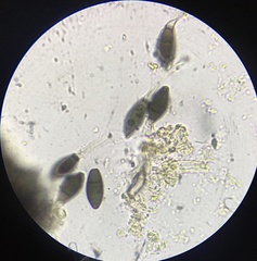 Cercophora silvatica