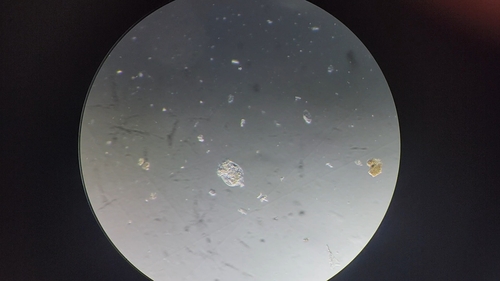 Brachionus angularis