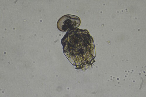 Brachionus angularis