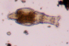 Macrotrachela plicata