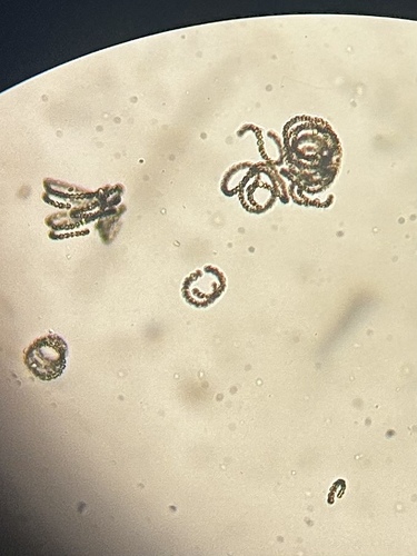 Dolichospermum circinale, 2026-06-26
