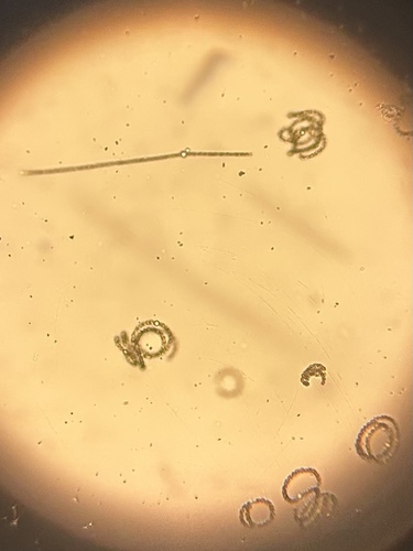 Dolichospermum circinale, 2026-06-26
