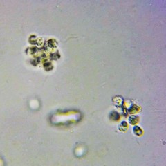 Spumella