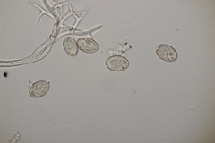 Peronospora dipsaci
