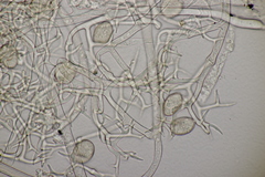 Peronospora dipsaci