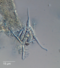 Tetracladium setigerum