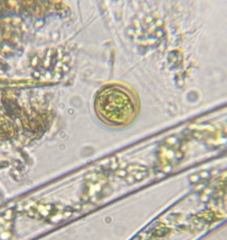 Trachelomonas volvocina