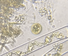 Trachelomonas volvocina