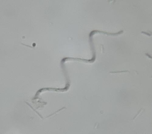 Lyngbya observed 2026-06-30