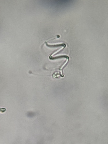 Lyngbya observed 2026-07-05