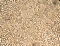 Saccharomyces cerevisiae