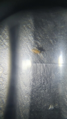 Entomobrya intermedia