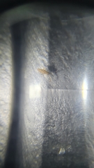 Entomobrya intermedia