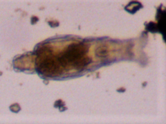 Macrotrachela plicata