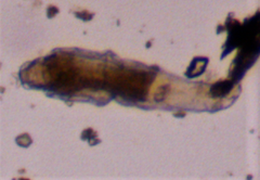 Macrotrachela plicata