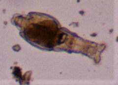 Macrotrachela plicata