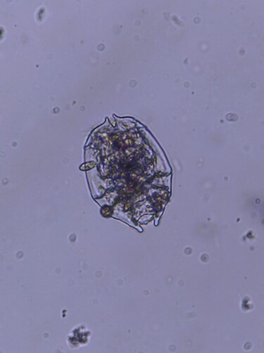 Brachionus angularis