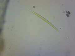 Monoraphidium griffithii