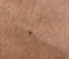 Rhipicephalus sanguineus