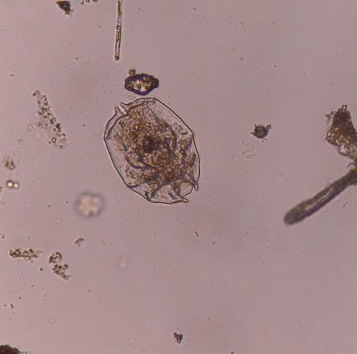 Brachionus angularis
