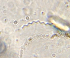 Spirochaetae