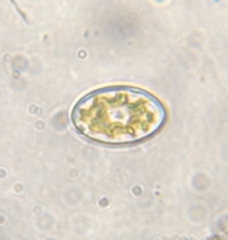 Cocconeis