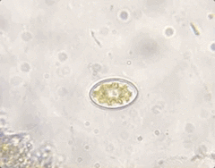 Cocconeis
