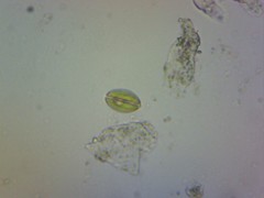 Cryptoglena