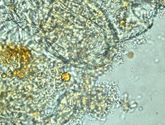 Acanthocyclops venustus