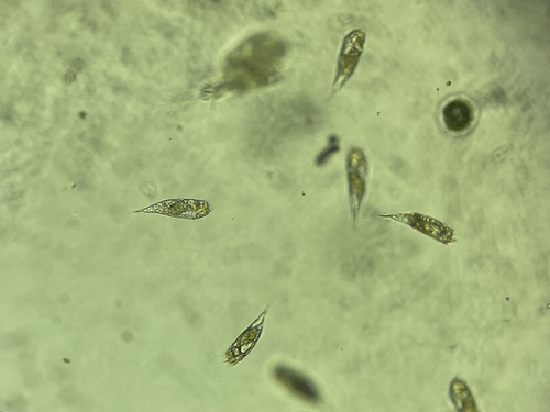 Trichocerca similis